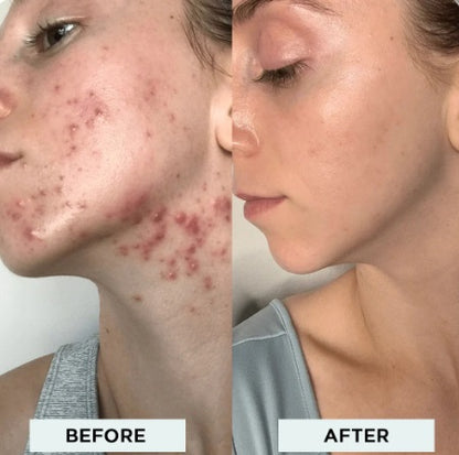 Bloom and Play™ Clear Glow High Frequency Wand