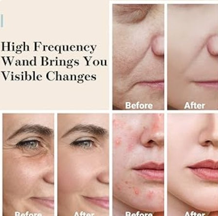 Bloom and Play™ Clear Glow High Frequency Wand
